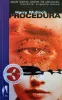 Procedura